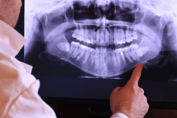 Best 24-Hour Emergency Dentist in Canton, TX