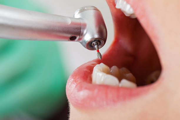 Best Walk-In Emergency Dentist in Canton, TX